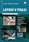 Lepení v praxi