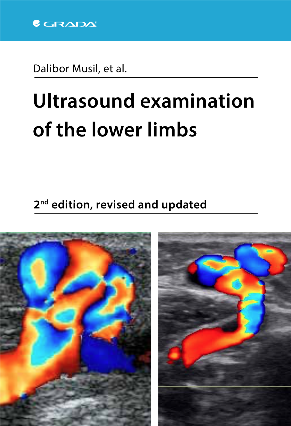 Ultrasound examination of the lower limbs e-kniha | Levneknihy.cz